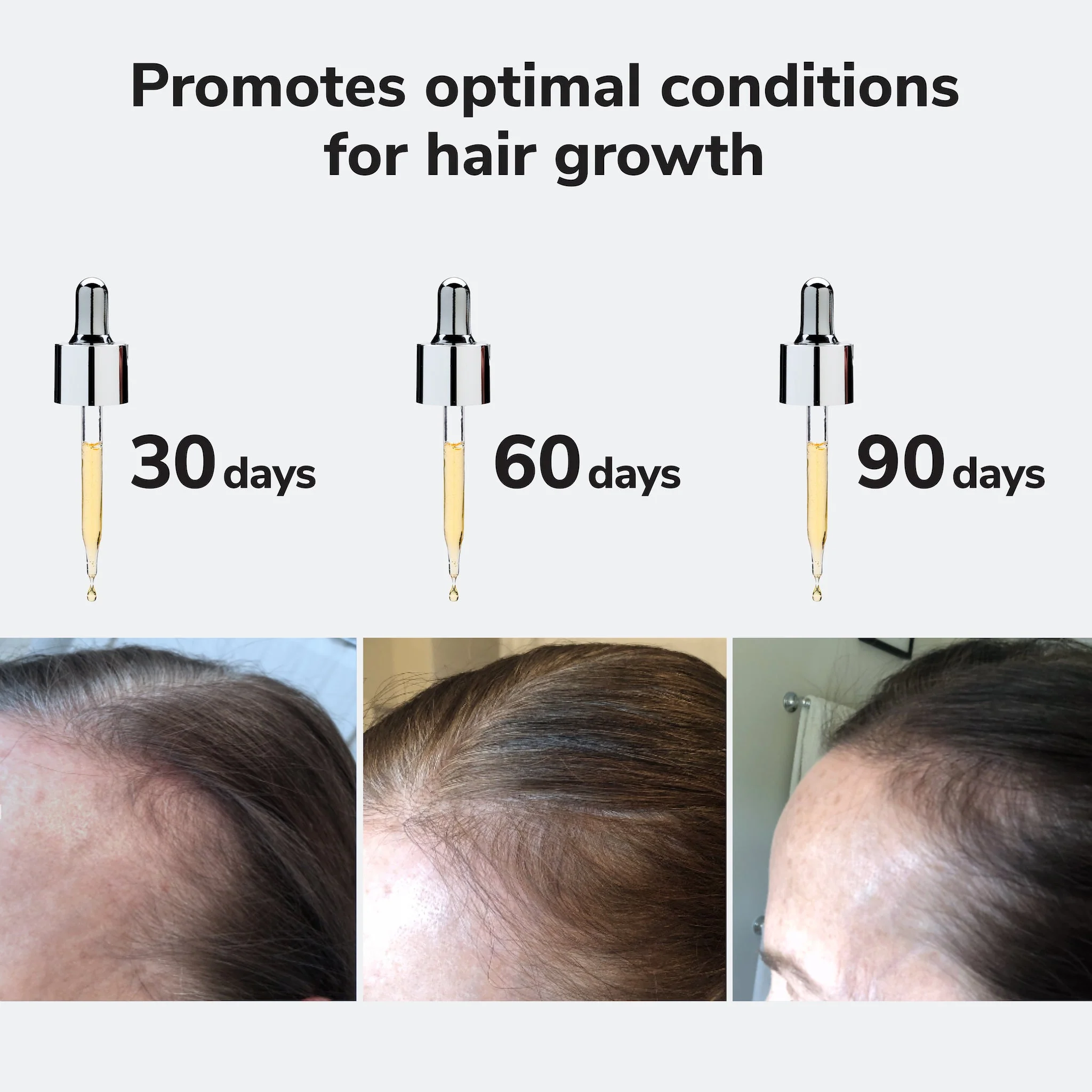Optimal Scalp Treatment Bundle - Image 6